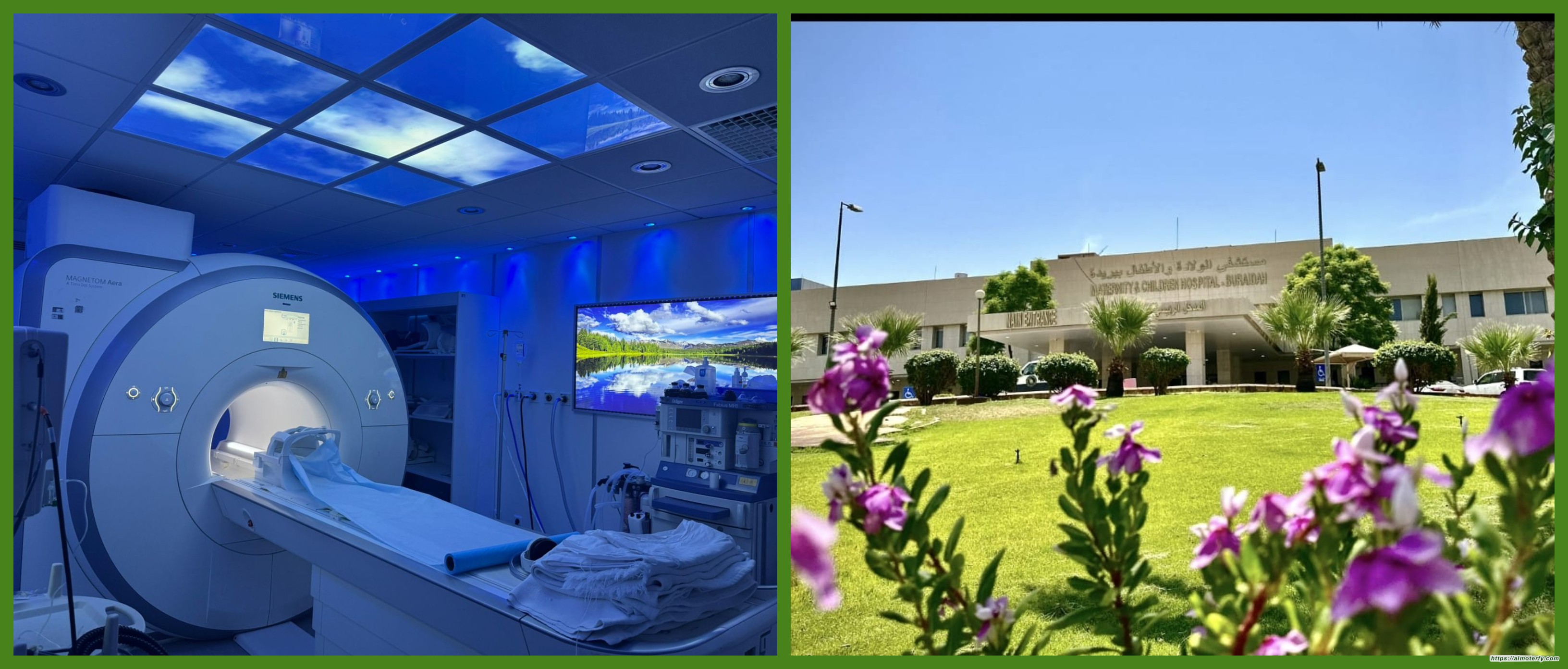 إطلاق خدمة تصوير الرنين المغناطيسي للأجنة بمستشفى الولادة والأطفال ببريدة